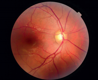 {{brizy_dc_image_alt imageSrc=